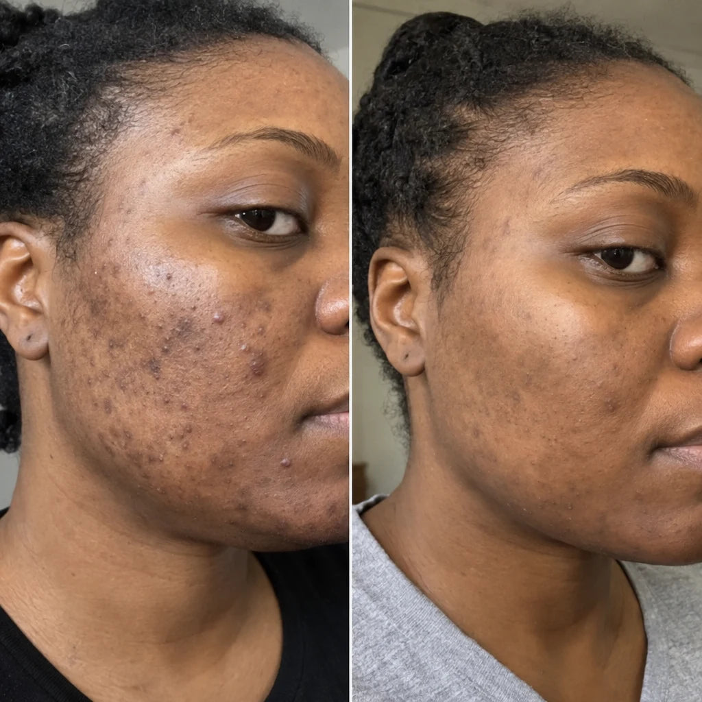 Nadia, 39, before and after 8 weeks
