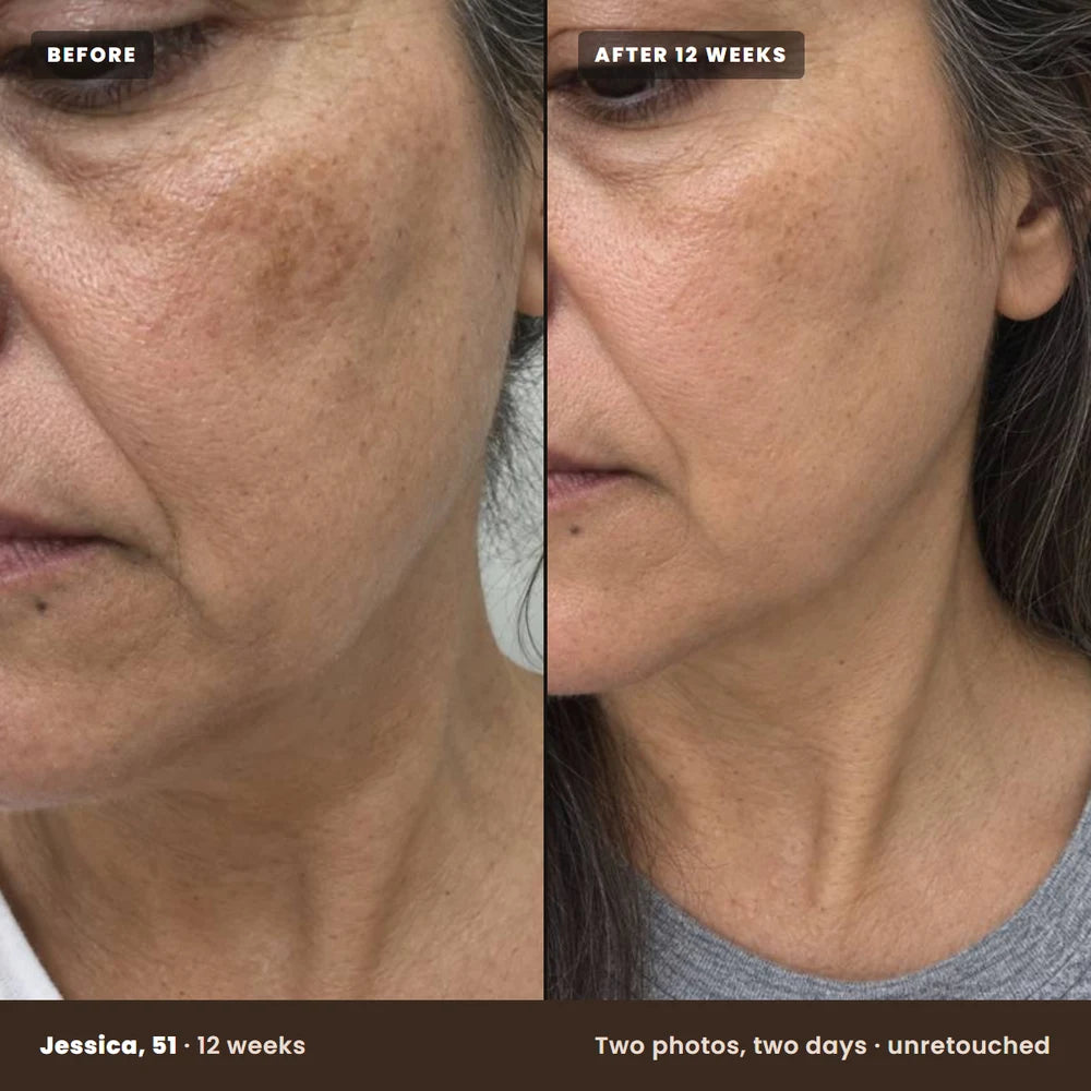Colleen, 52, before and after 12 weeks